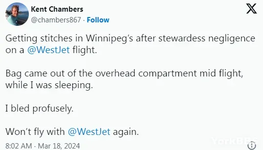 加拿大小伙在飞机上熟睡 竟被行李砸得头破血流