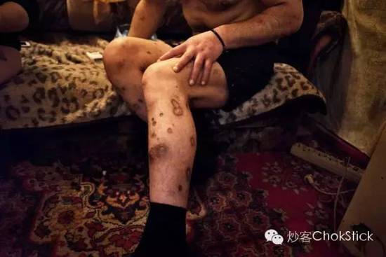 10 大死亡猛药逐个数: 就在我们身边,只是你不知道