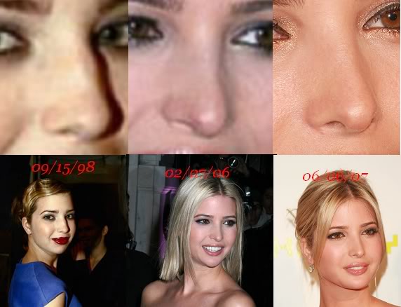20170228_14883281654178.jpg Ivanka_nose_jobs.jpg