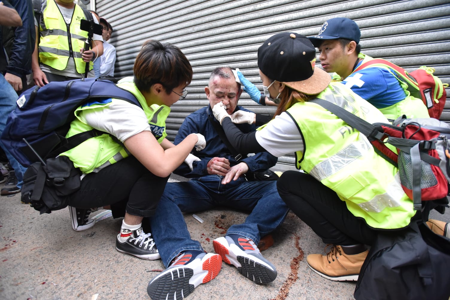 急救人员为该日本游客治理伤势。（图源：香港《星岛日报》）