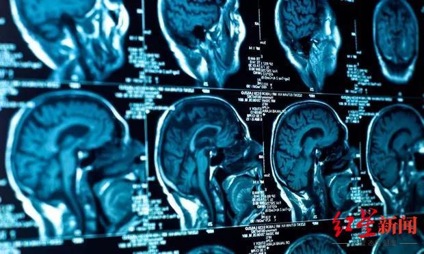 ▲年轻人出现了令人不安的症状,包括体重迅速下降、失眠、幻觉和活动受限。资料图据网络