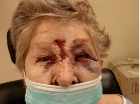 重磅!加拿大CBS发红色警报 温哥华医院刚又爆雷 重磅!加拿大CBS发红色警报 温哥华医院刚又爆雷