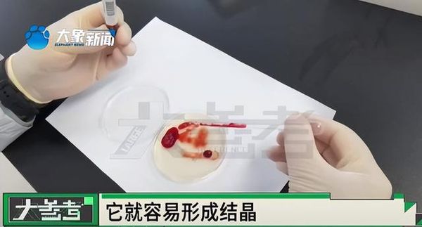 豪饮500ml&ldquo;防冻液&rdquo; 陆男&ldquo;血如胶冻&rdquo;不治亡