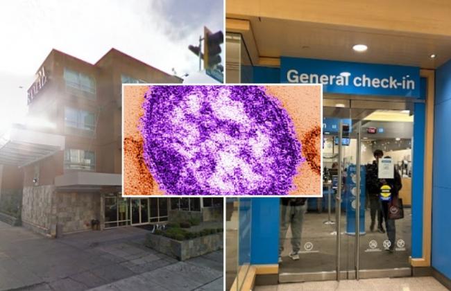 卑诗麻疹首例列治文出现 曾到这两个地点或有风险 卑诗麻疹首例列治文出现 曾到这两个地点或有风险