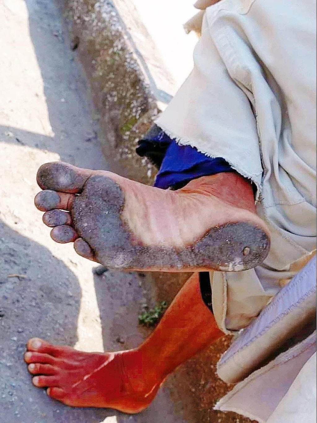 「释明慧」苦行千里走赤脚底变黑。 facebook 「释明慧」苦行千里走赤脚底变黑。 facebook