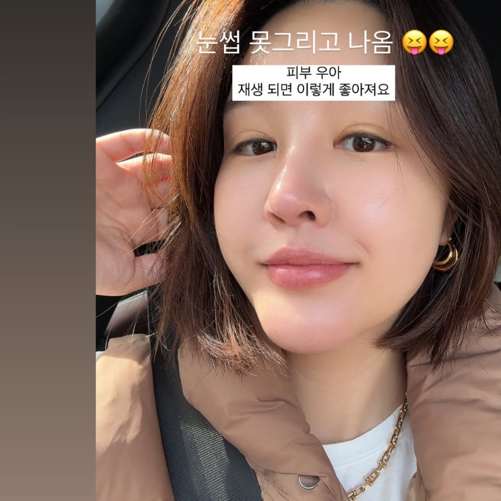 朴恩智表示，她亦曾于电视台受到霸凌长达7年。（IG@egeeparkcom）